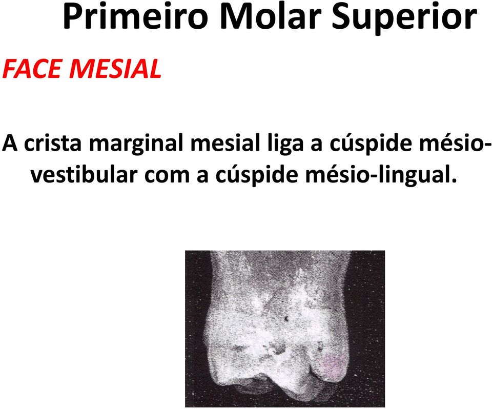 cúspide mésiovestibular