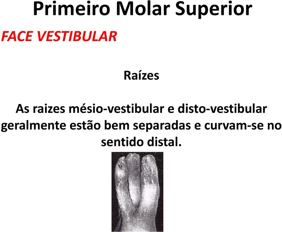 disto-vestibular geralmente