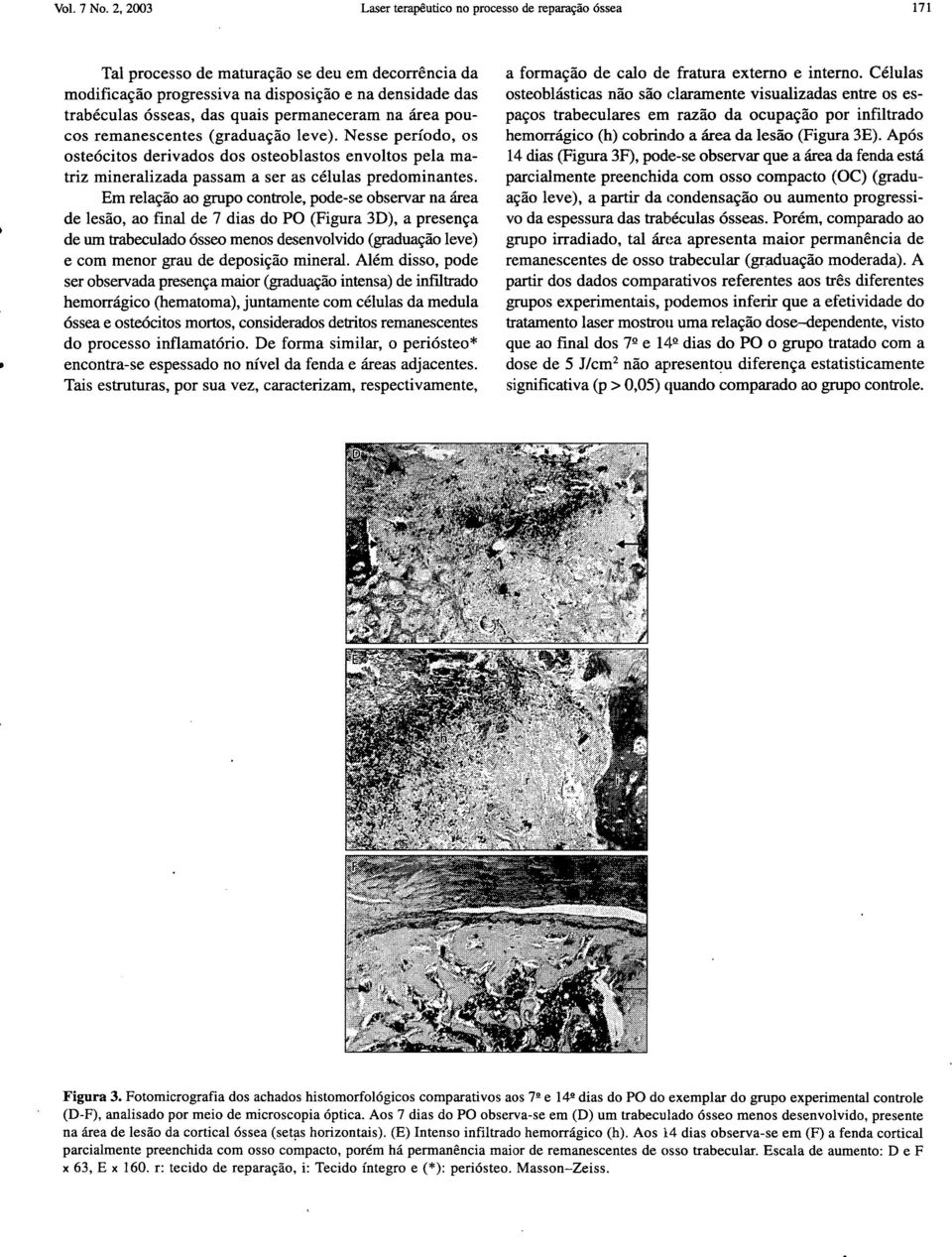 permaneceram na área poucos remanescentes (graduação leve). Nesse período, os osteócitos derivados dos osteoblastos envoltos pela matriz mineralizada passam a ser as células predominantes.