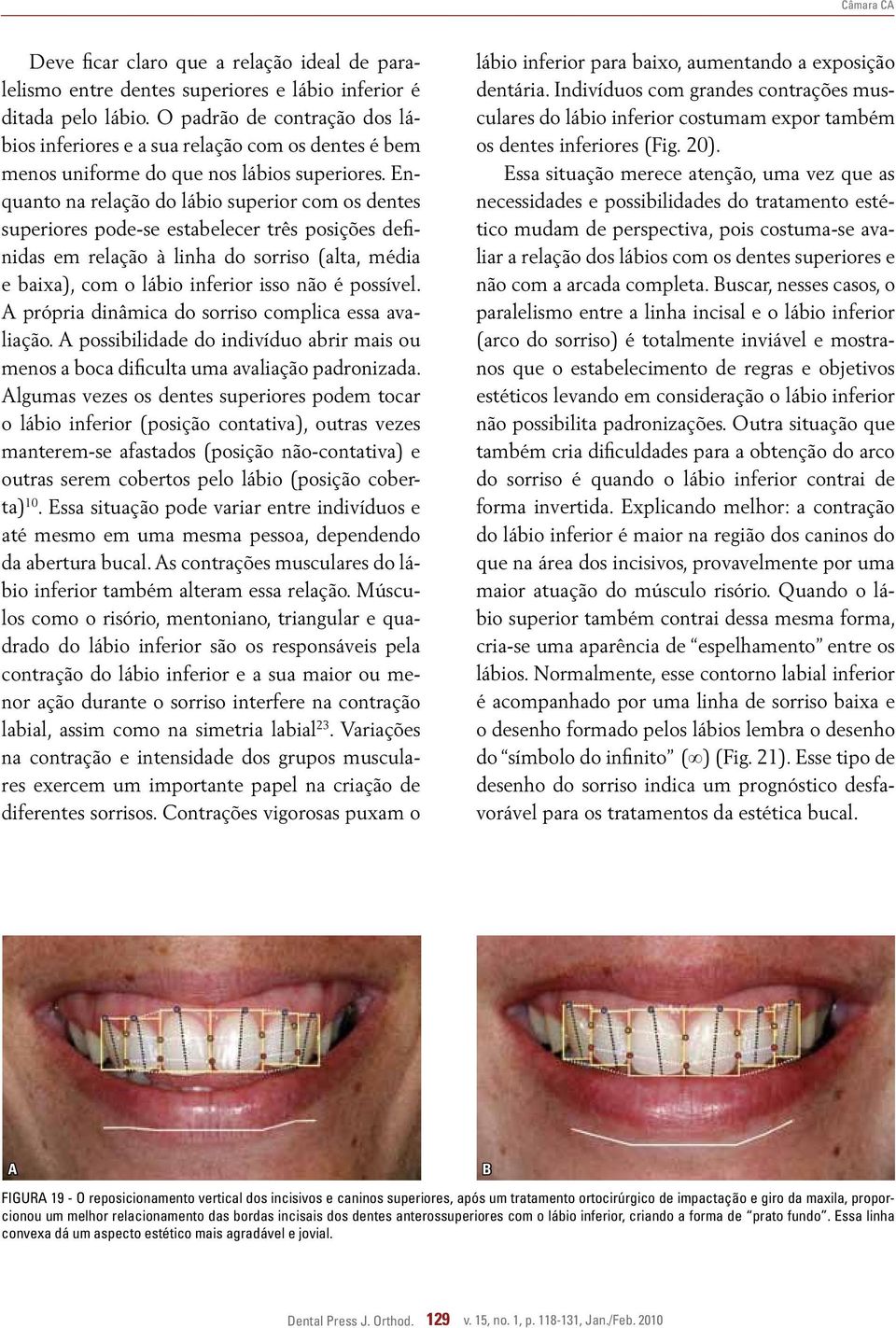 Enquanto na relação do lábio superior com os dentes superiores pode-se estabelecer três posições definidas em relação à linha do sorriso (alta, média e baixa), com o lábio inferior isso não é