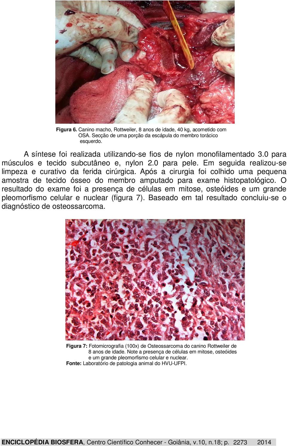 Após a cirurgia foi colhido uma pequena amostra de tecido ósseo do membro amputado para exame histopatológico.