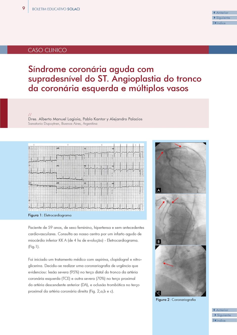 antecedentes cardiovasculares. Consulta ao nosso centro por um infarto agudo de miocárdio inferior KK A (de 4 hs de evolução) - Eletrocardiograma. (Fig.1).