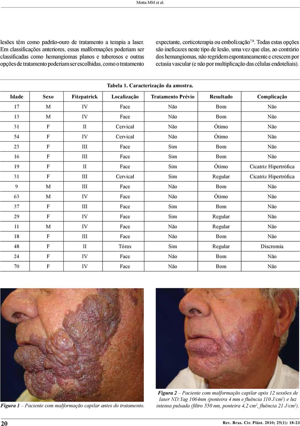 corticoterapia ou embolização 7,8.