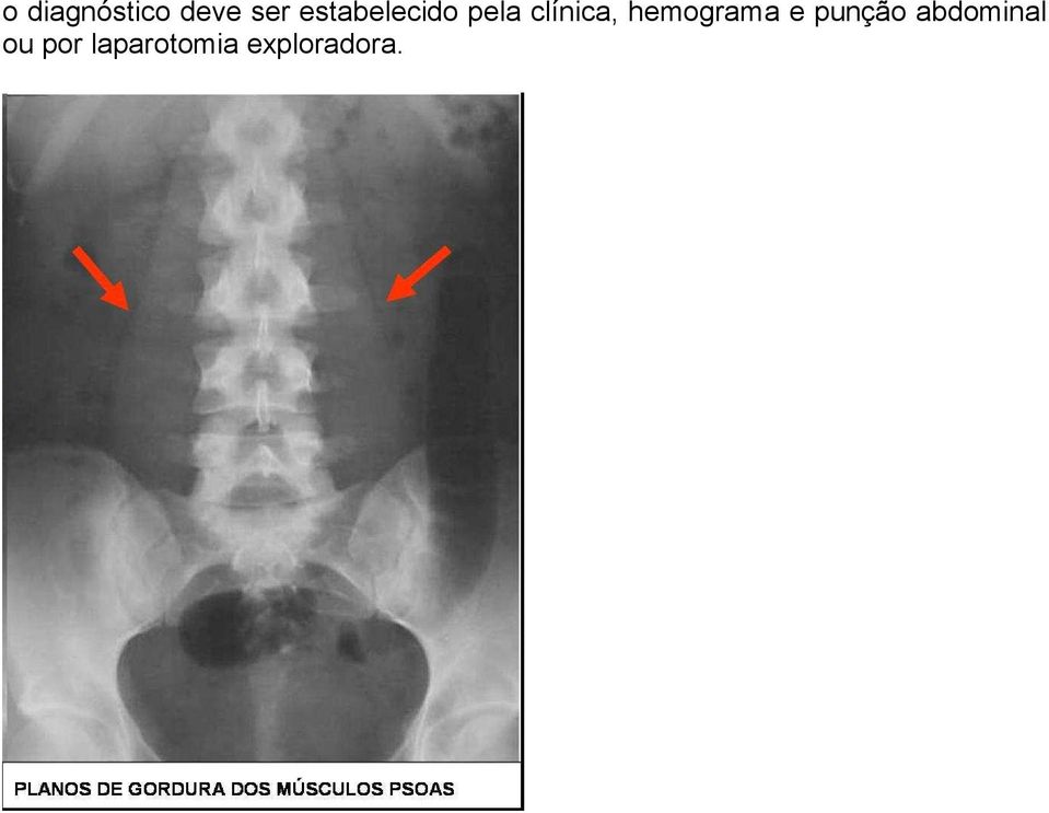 hemograma e punção