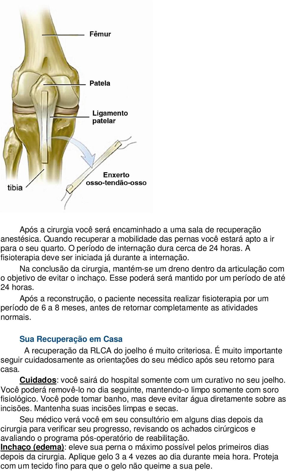 Na conclusão da cirurgia, mantém-se um dreno dentro da articulação com o objetivo de evitar o inchaço. Esse poderá será mantido por um período de até 24 horas.