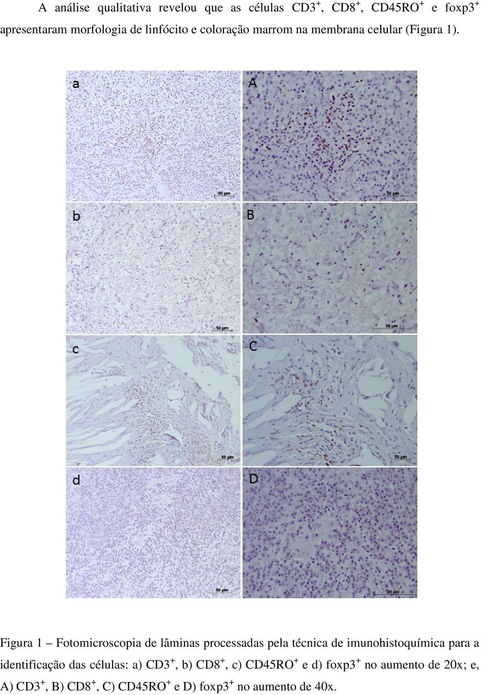 Figura 1 Fotomicroscopia de lâminas processadas pela técnica de imunohistoquímica para a identificação