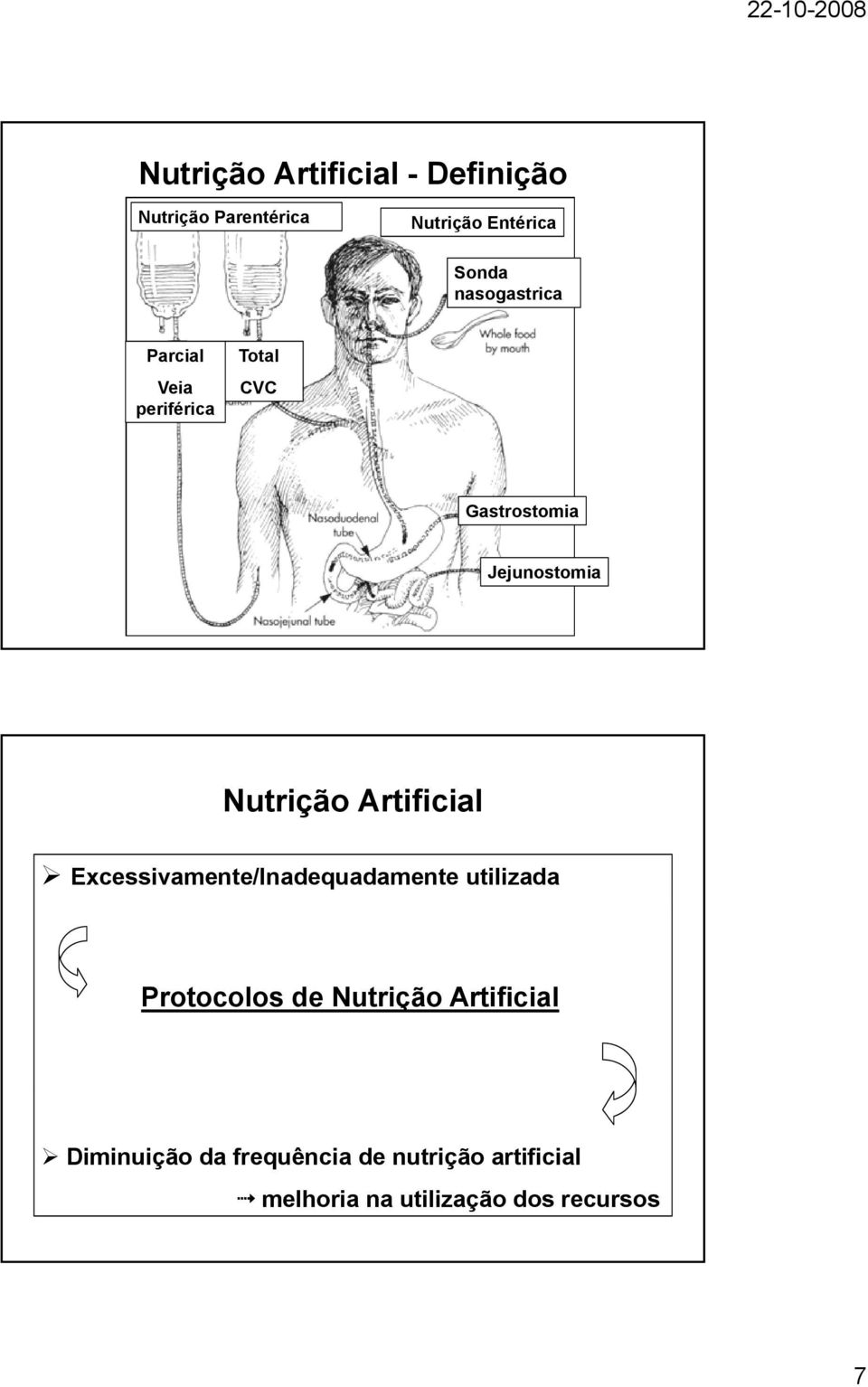 Artificial Excessivamente/Inadequadamente utilizada Protocolos de Nutrição