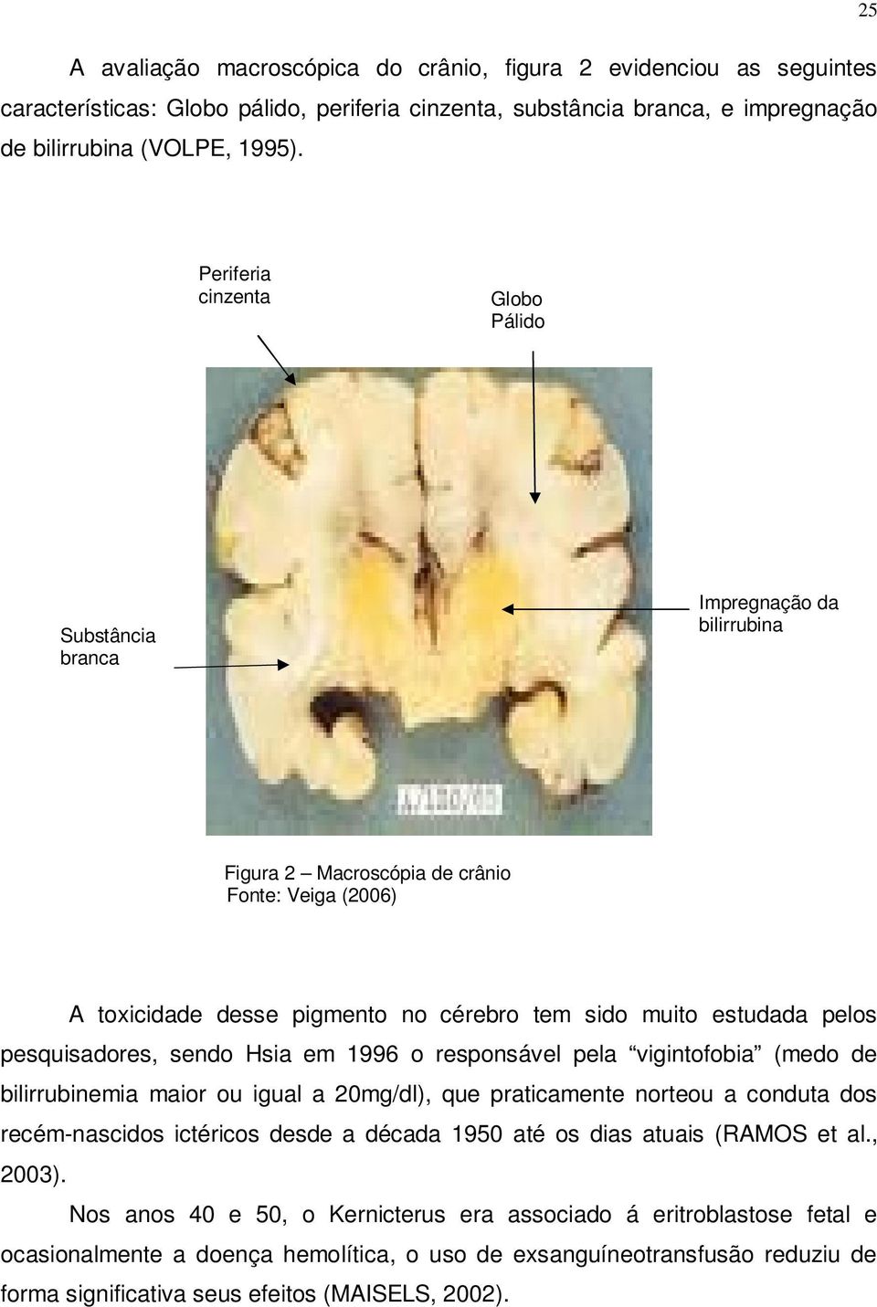 pesquisadores, sendo Hsia em 1996 o responsável pela vigintofobia (medo de bilirrubinemia maior ou igual a 20mg/dl), que praticamente norteou a conduta dos recém-nascidos ictéricos desde a década