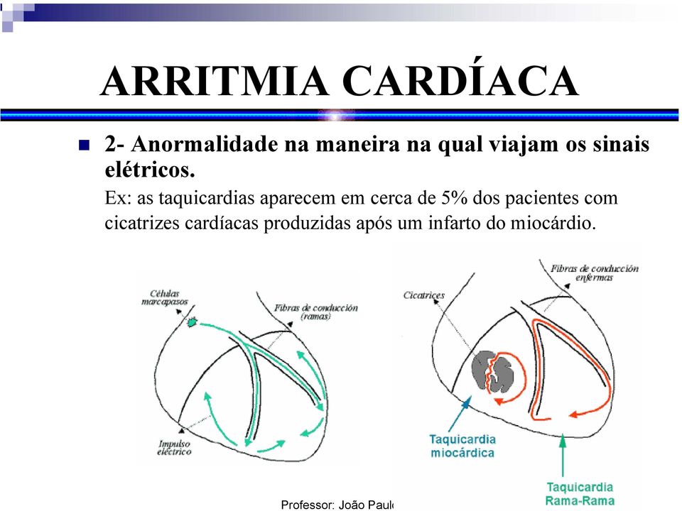 Ex: as taquicardias aparecem em cerca de 5% dos