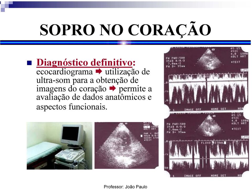 a obtenção de imagens do coração permite a