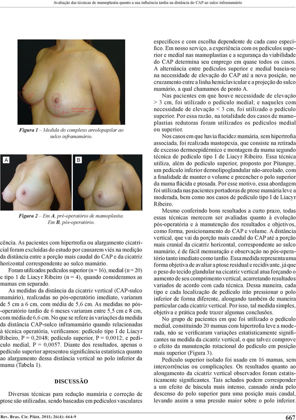 s pacientes com hipertrofia ou alargamento cicatricial foram excluídas do estudo por causarem viés na medição da distância entre a porção mais caudal do CP e da cicatriz horizontal correspondente ao