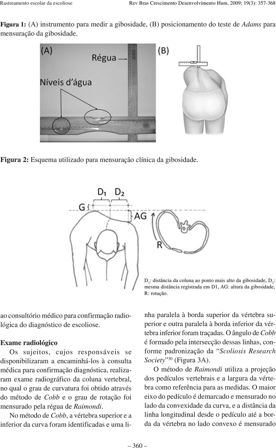 ao consultório médico para confirmação radiológica do diagnóstico de escoliose.