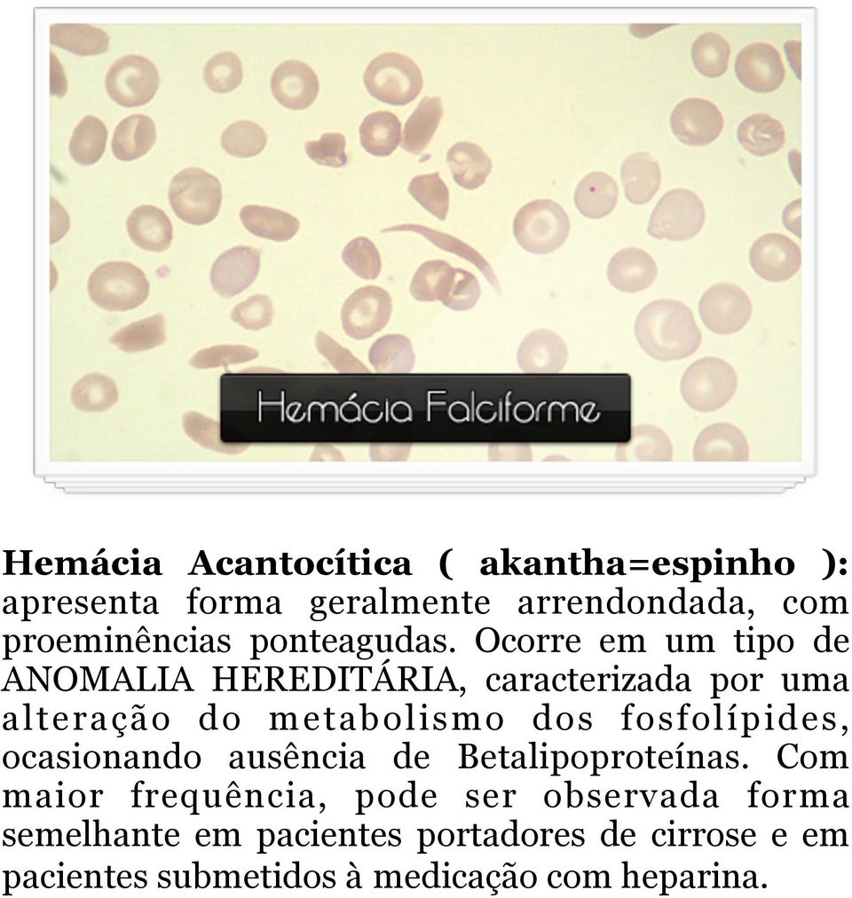 Ocorre em um tipo de ANOMALIA HEREDITÁRIA, caracterizada por uma alteração do metabolismo dos