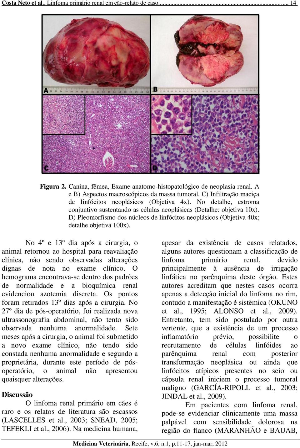 D) Pleomorfismo dos núcleos de linfócitos neoplásicos (Objetiva 40x; detalhe objetiva 100x).