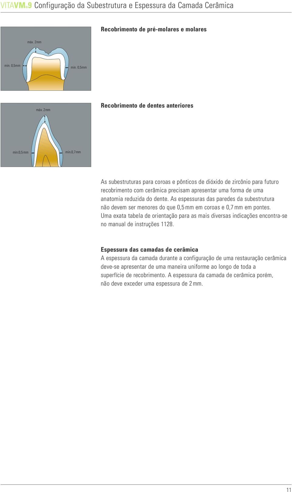 reduzida do dente. As espessuras das paredes da subestrutura não devem ser menores do que 0,5 mm em coroas e 0,7 mm em pontes.