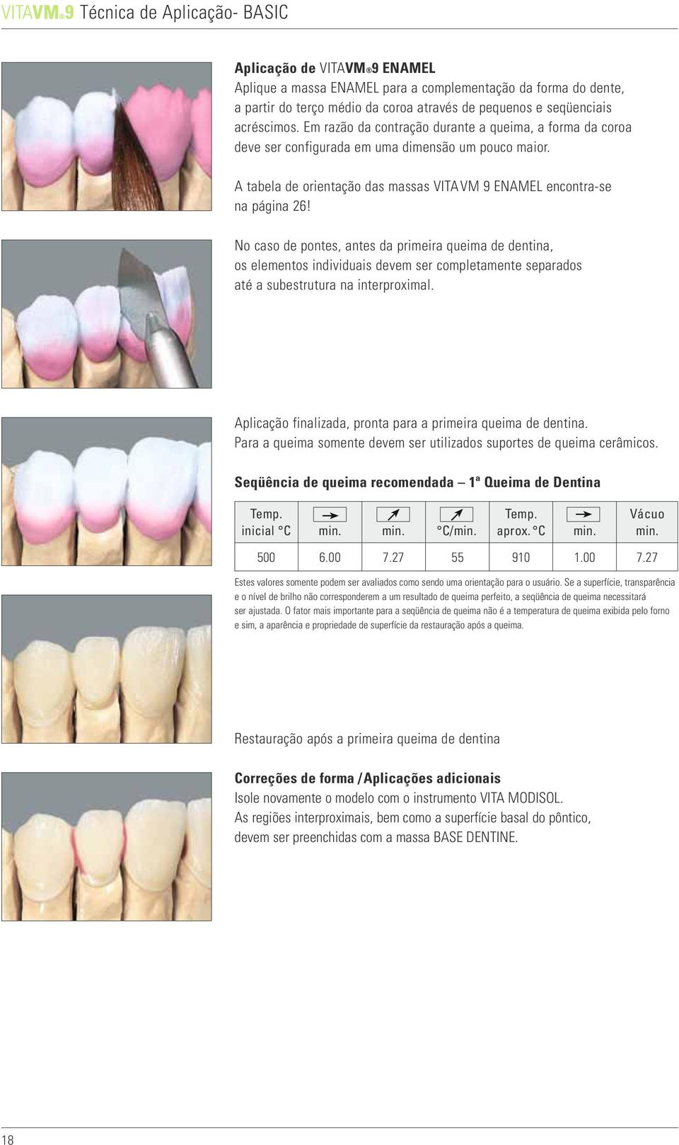 No caso de pontes, antes da primeira queima de dentina, os elementos individuais devem ser completamente separados até a subestrutura na interproximal.