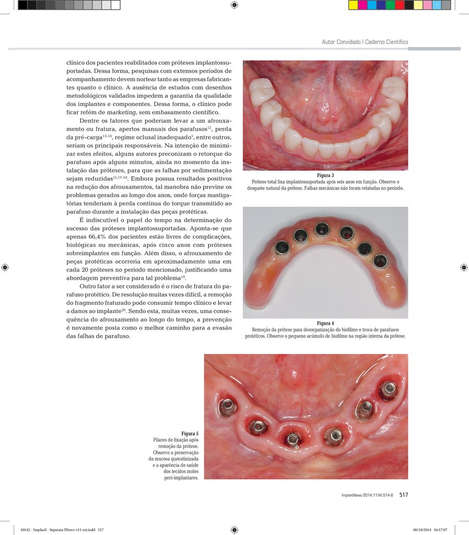 A ausência de estudos com desenhos metodológicos validados impedem a garantia da qualidade dos implantes e componentes.