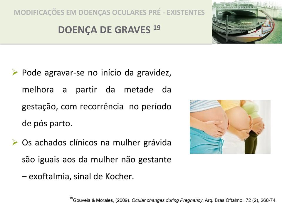 Os achados clínicos na mulher grávida são iguais aos da mulher não gestante exoftalmia, sinal de