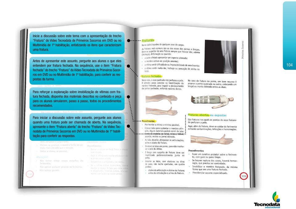 Na sequência, use o item Fratura fechada do trecho Fratura do Vídeo Tecnodata de Primeiros Socorros em DVD ou no Multimídia de 1ª habilitação, para conferir as respostas da turma.