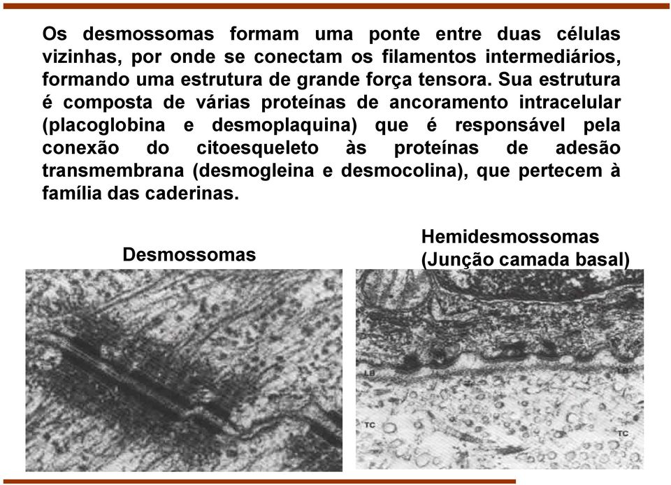 Sua estrutura é composta de várias proteínas de ancoramento intracelular (placoglobina e desmoplaquina) que é