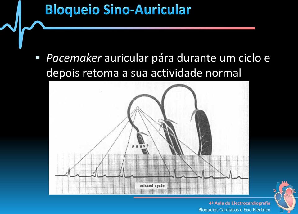 ciclo e depois