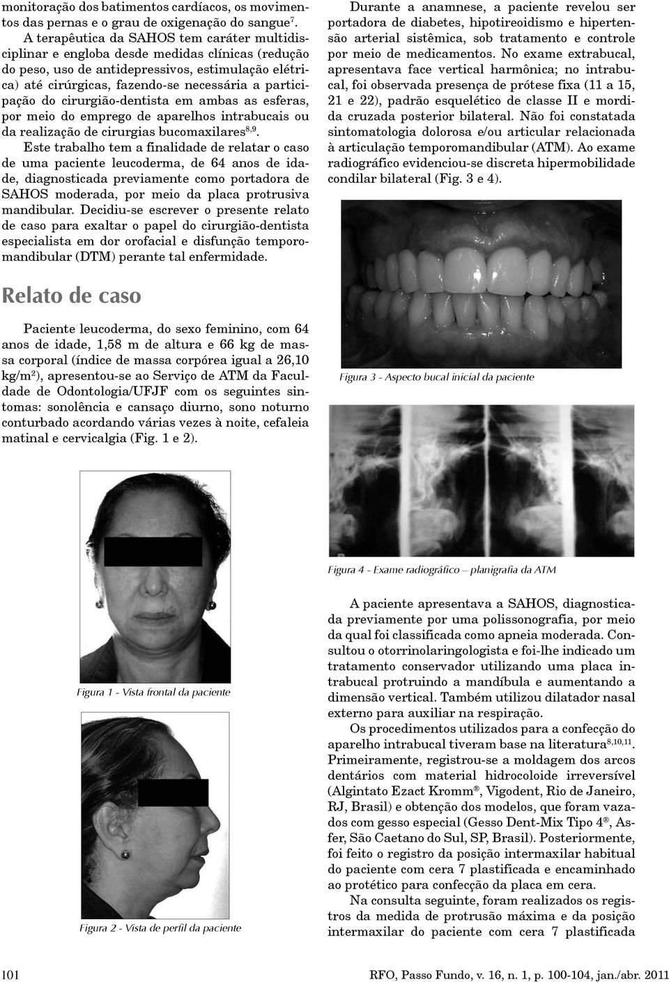 participação do cirurgião-dentista em ambas as esferas, por meio do emprego de aparelhos intrabucais ou da realização de cirurgias bucomaxilares 8,9.