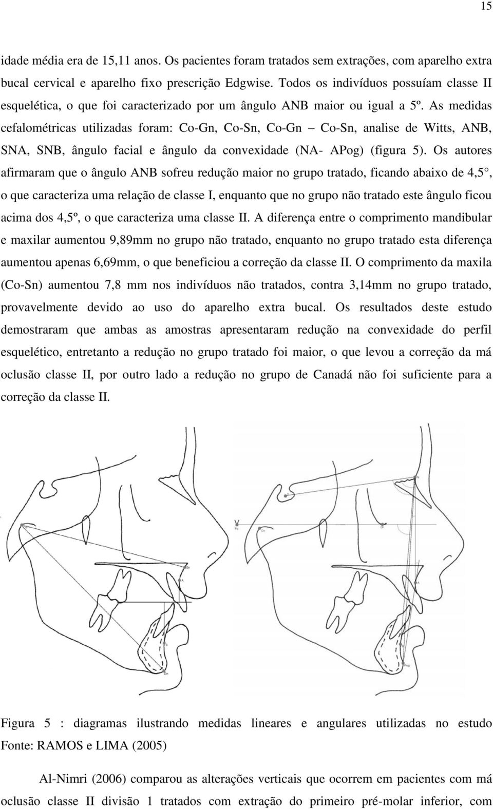 As medidas cefalométricas utilizadas foram: Co-Gn, Co-Sn, Co-Gn Co-Sn, analise de Witts, ANB, SNA, SNB, ângulo facial e ângulo da convexidade (NA- APog) (figura 5).