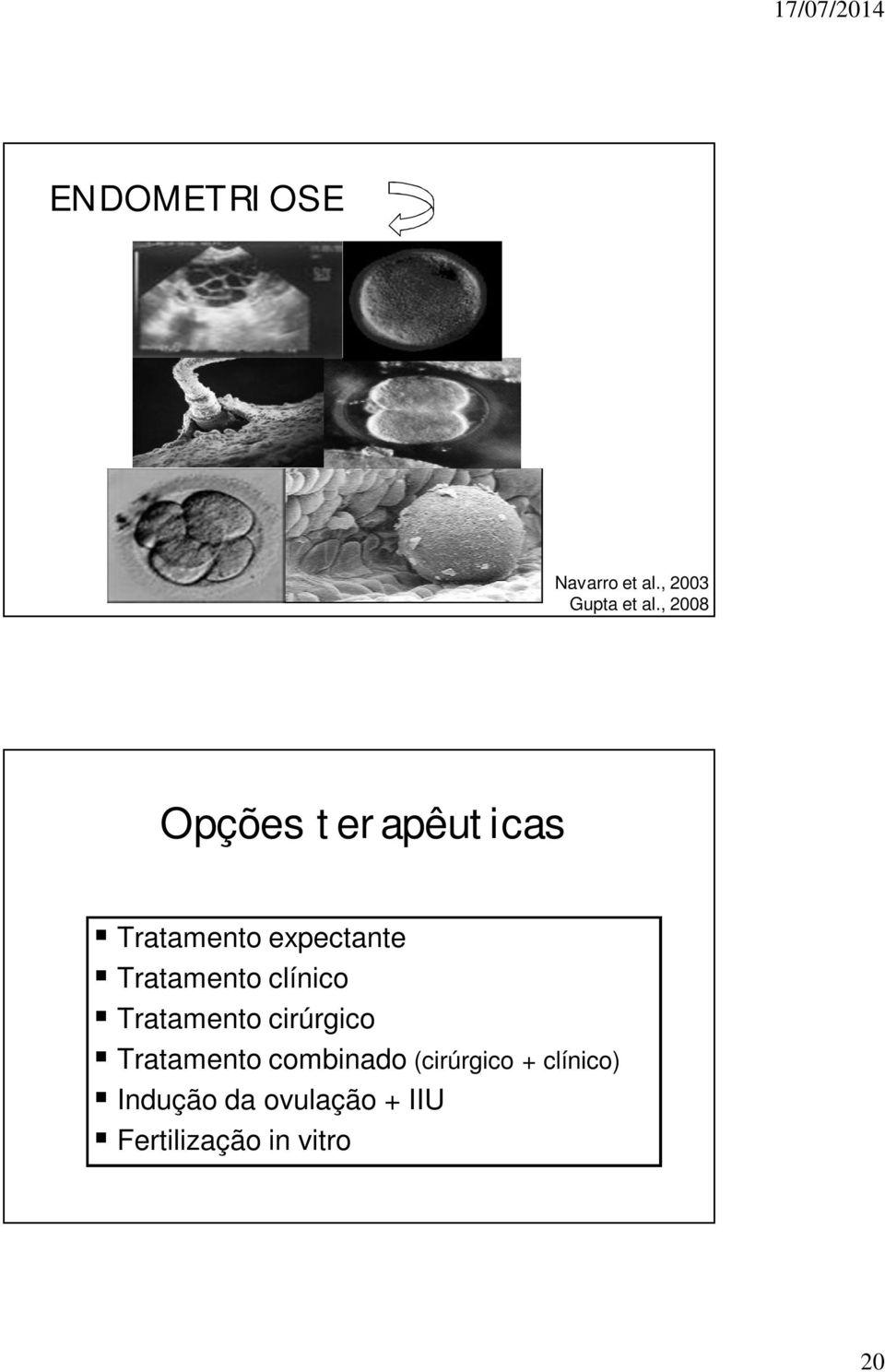 Tratamento clínico Tratamento cirúrgico Tratamento