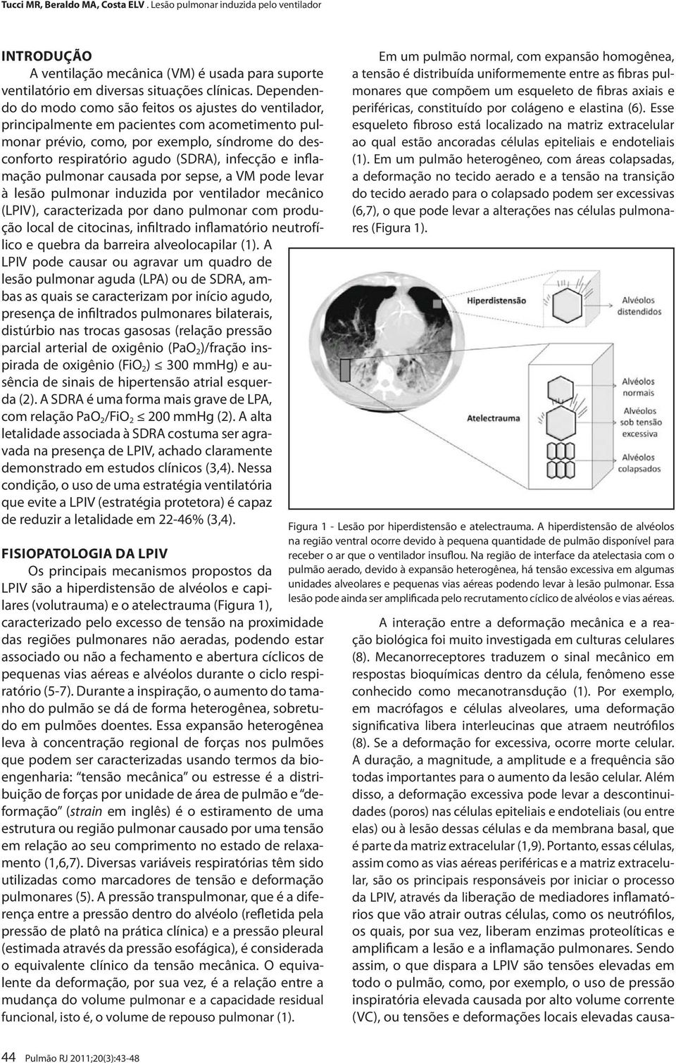 infecção e inflamação pulmonar causada por sepse, a VM pode levar à lesão pulmonar induzida por ventilador mecânico (LPIV), caracterizada por dano pulmonar com produção local de citocinas, infiltrado