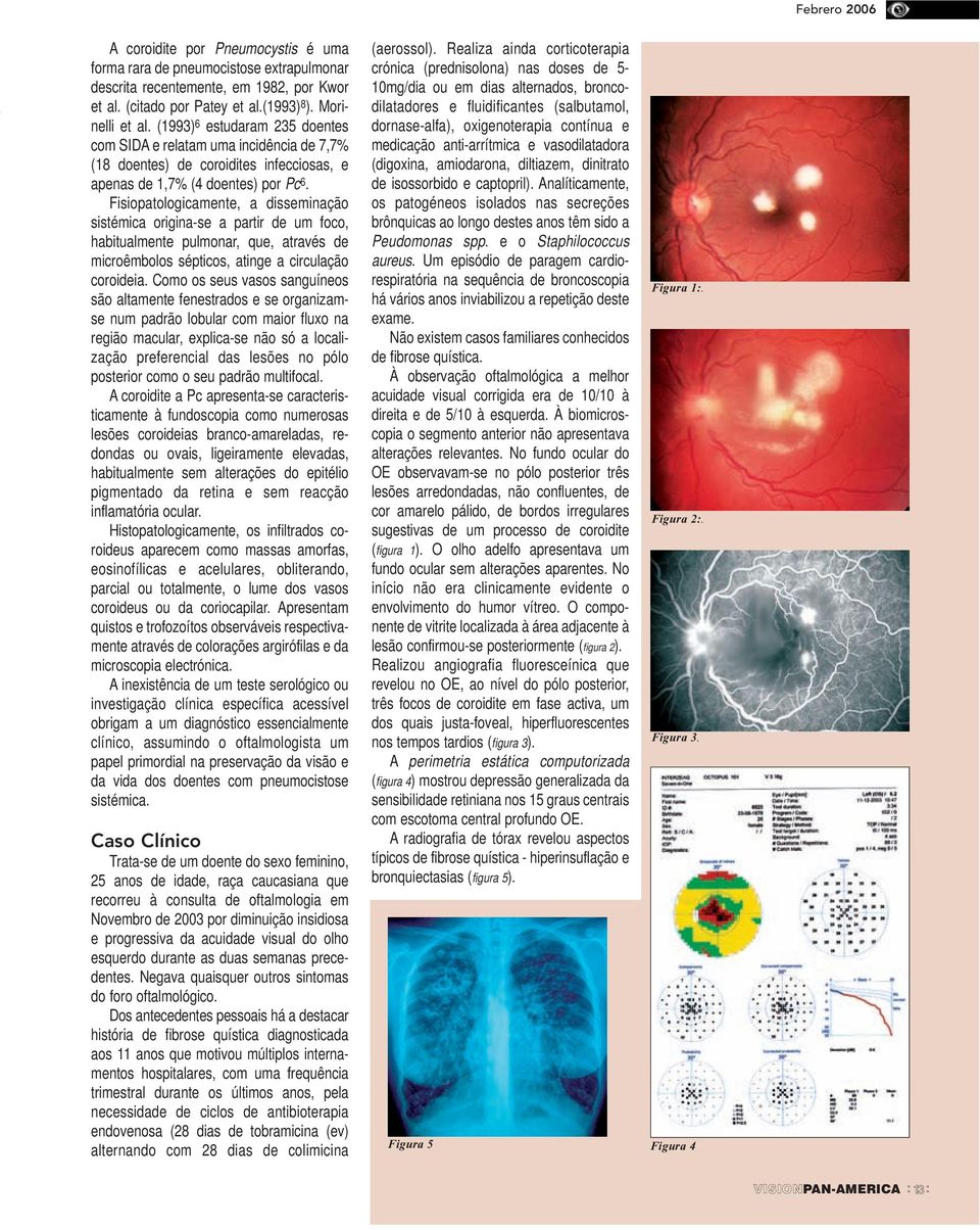 Fisiopatologicamente, a disseminação sistémica origina-se a partir de um foco, habitualmente pulmonar, que, através de microêmbolos sépticos, atinge a circulação coroideia.