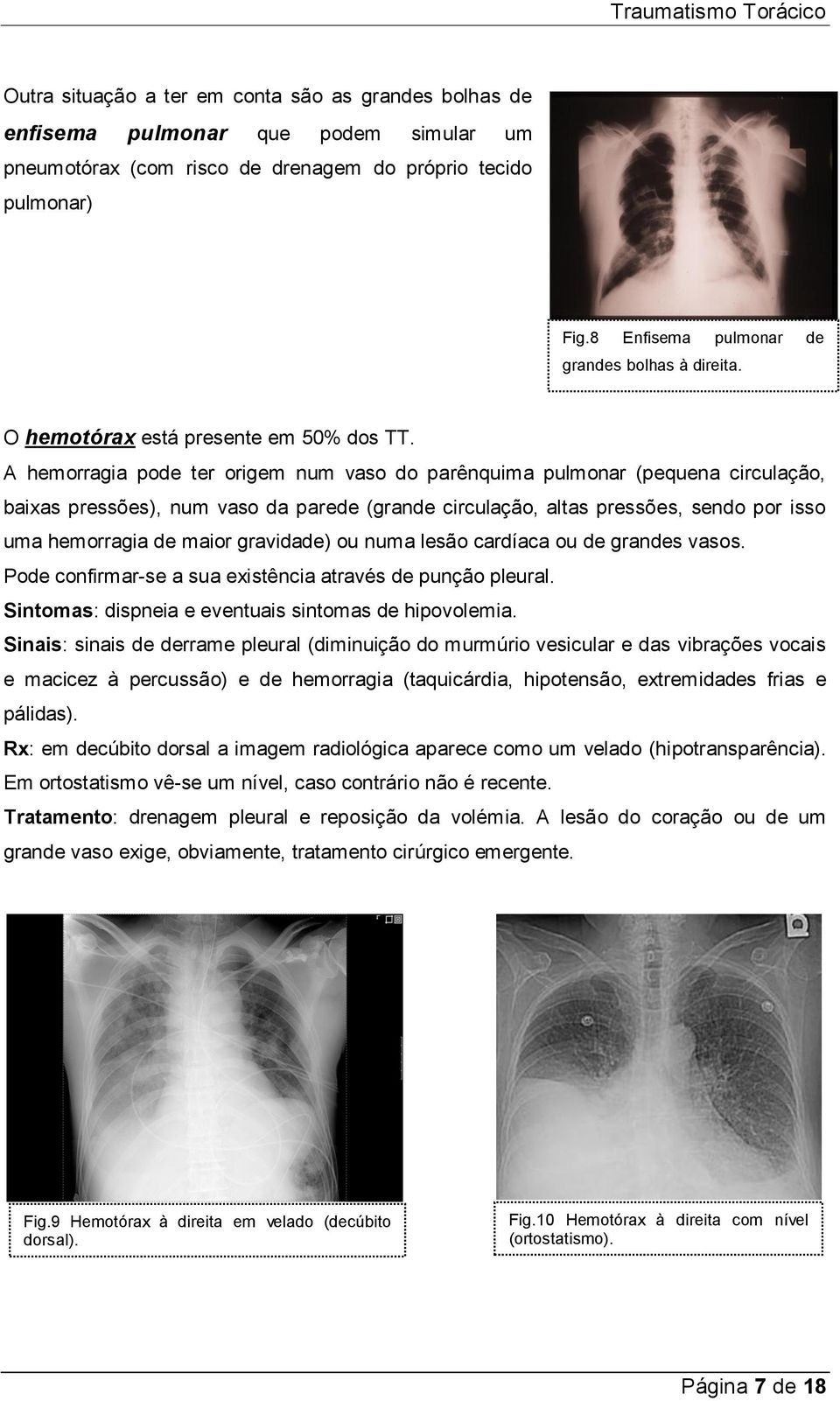 A hemorragia pode ter origem num vaso do parênquima pulmonar (pequena circulação, baixas pressões), num vaso da parede (grande circulação, altas pressões, sendo por isso uma hemorragia de maior