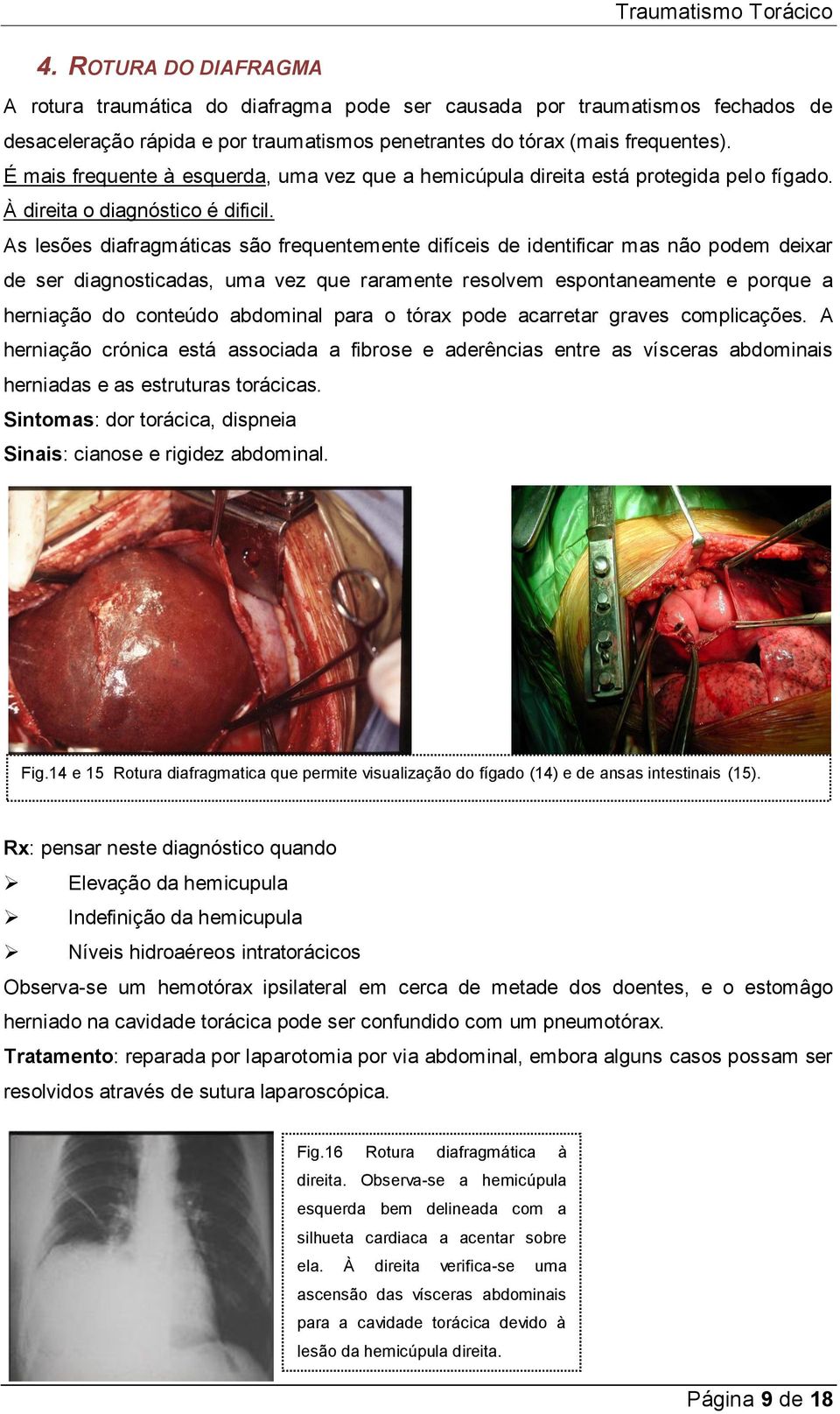 As lesões diafragmáticas são frequentemente difíceis de identificar mas não podem deixar de ser diagnosticadas, uma vez que raramente resolvem espontaneamente e porque a herniação do conteúdo