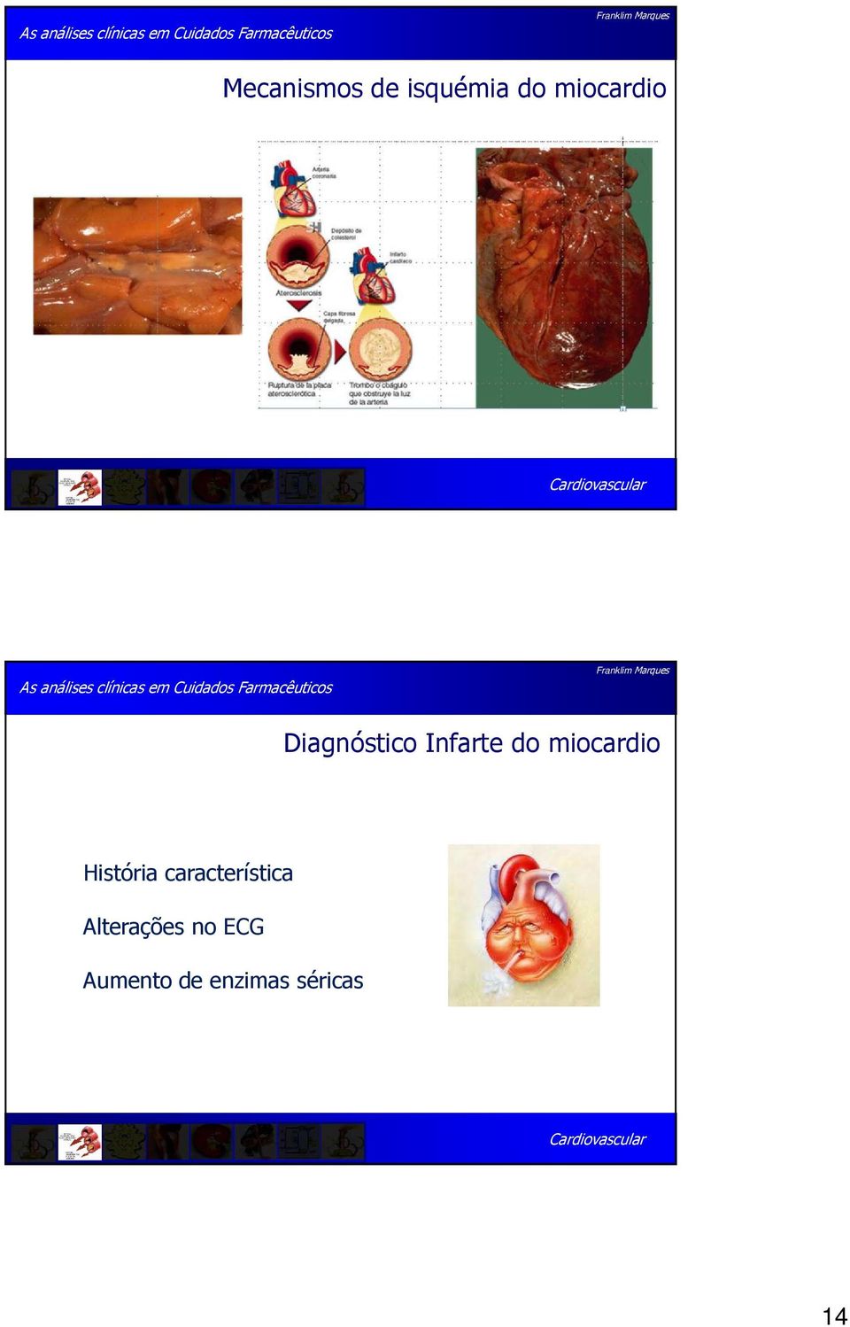 miocardio História característica