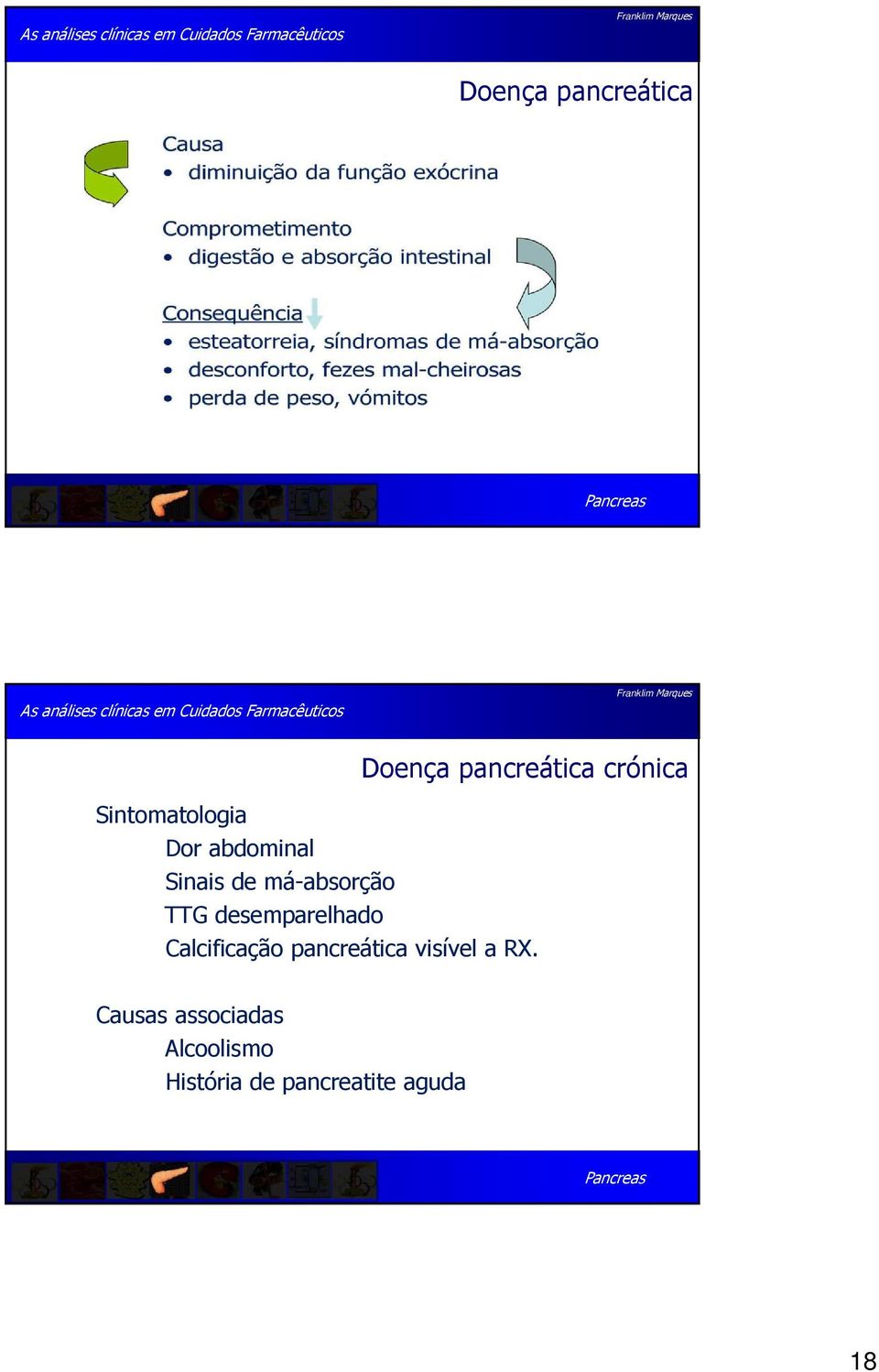 desemparelhado Calcificação pancreática visível a RX.