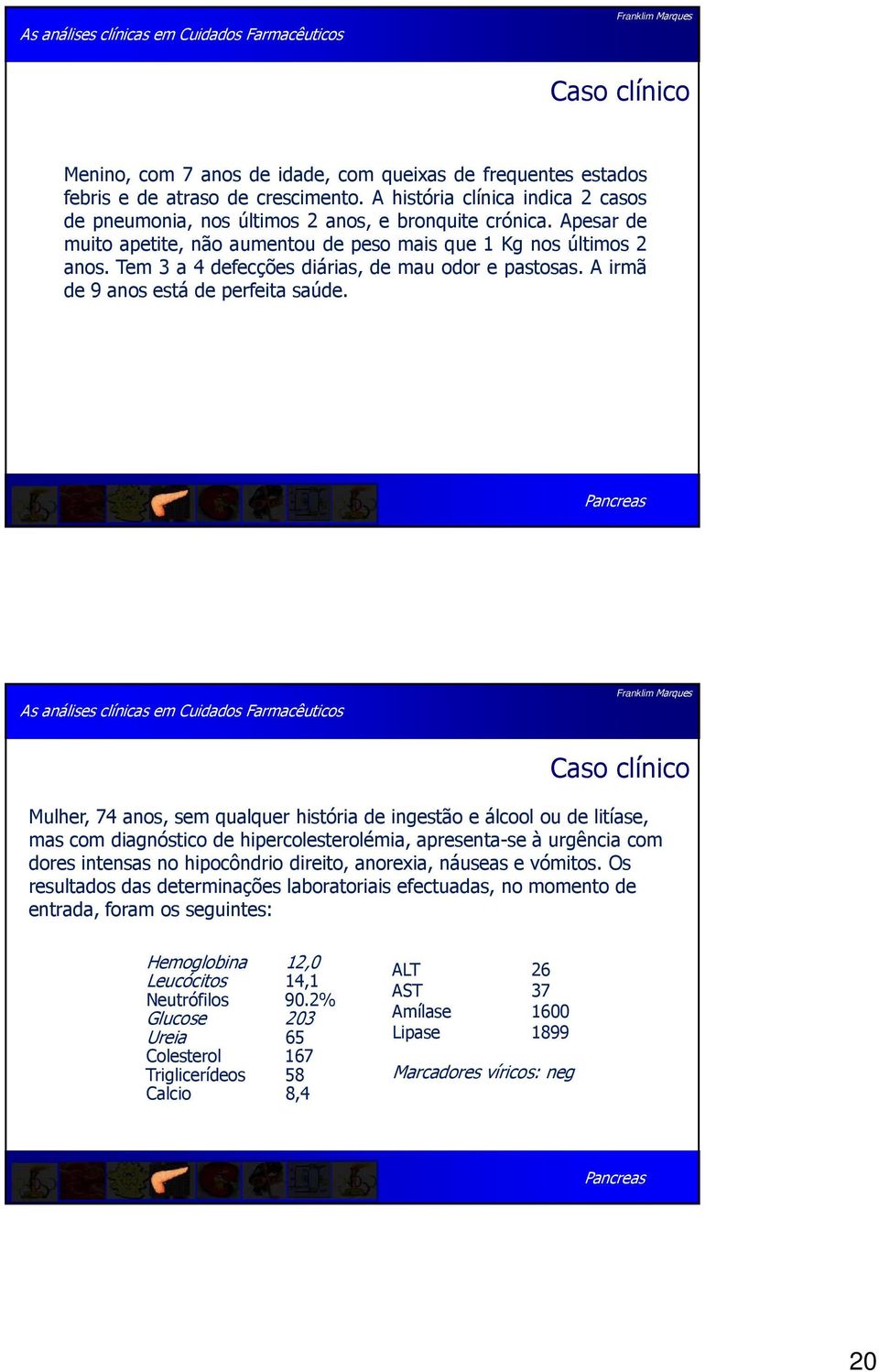 Pancreas Caso clínico Mulher, 74 anos, sem qualquer história de ingestão e álcool ou de litíase, mas com diagnóstico de hipercolesterolémia, apresenta-se à urgência com dores intensas no hipocôndrio