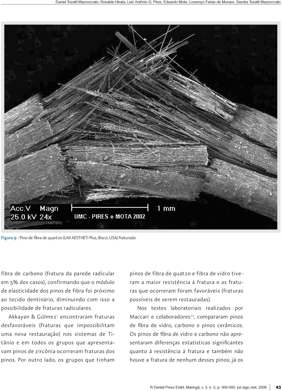 fibra de carbono (fratura da parede radicular em 5% dos casos), confirmando que o módulo de elasticidade dos pinos de fibra foi próximo ao tecido dentinário, diminuindo com isso a possibilidade de