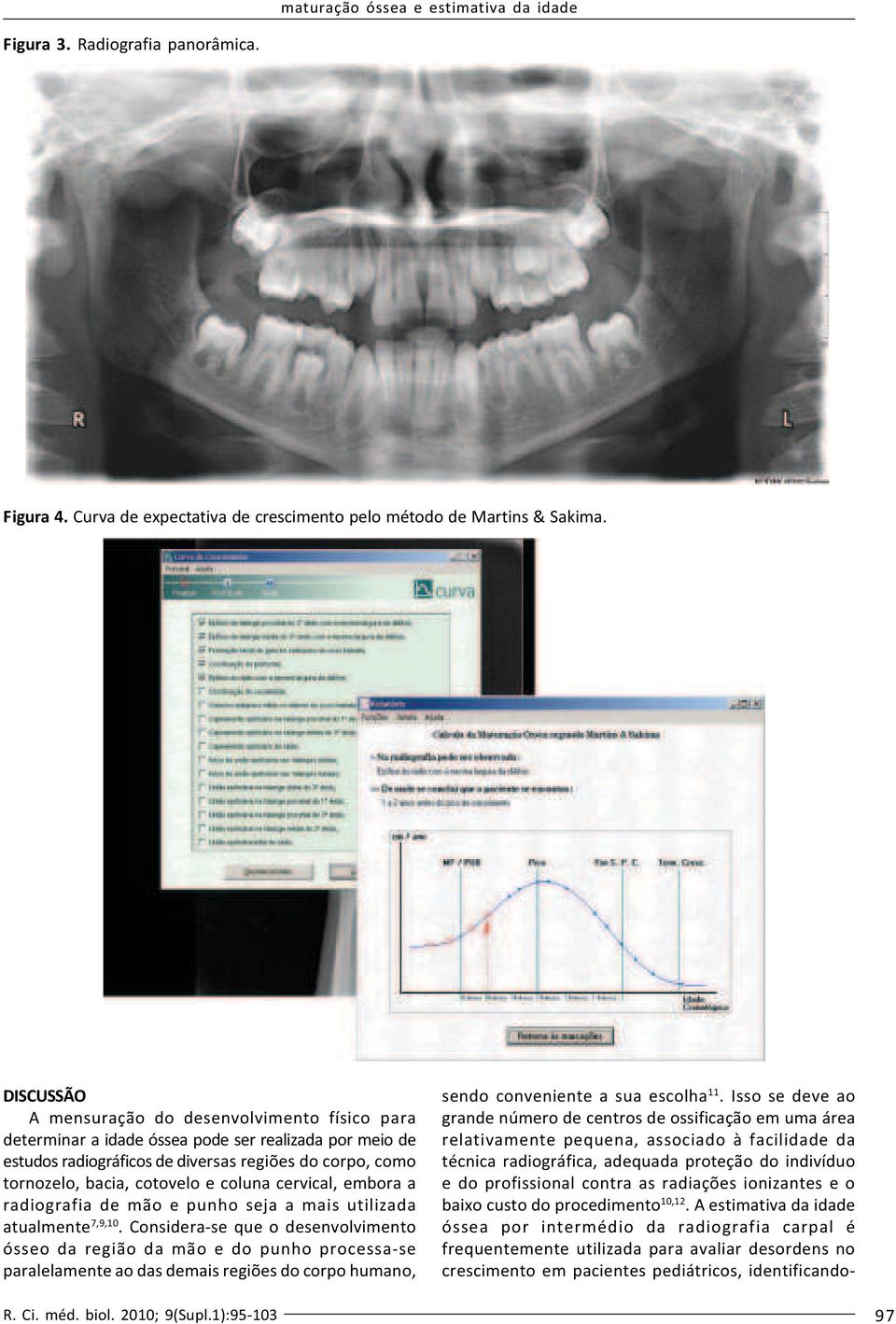 coluna cervical, embora a radiografia de mão e punho seja a mais utilizada atualmente 7,9,10.