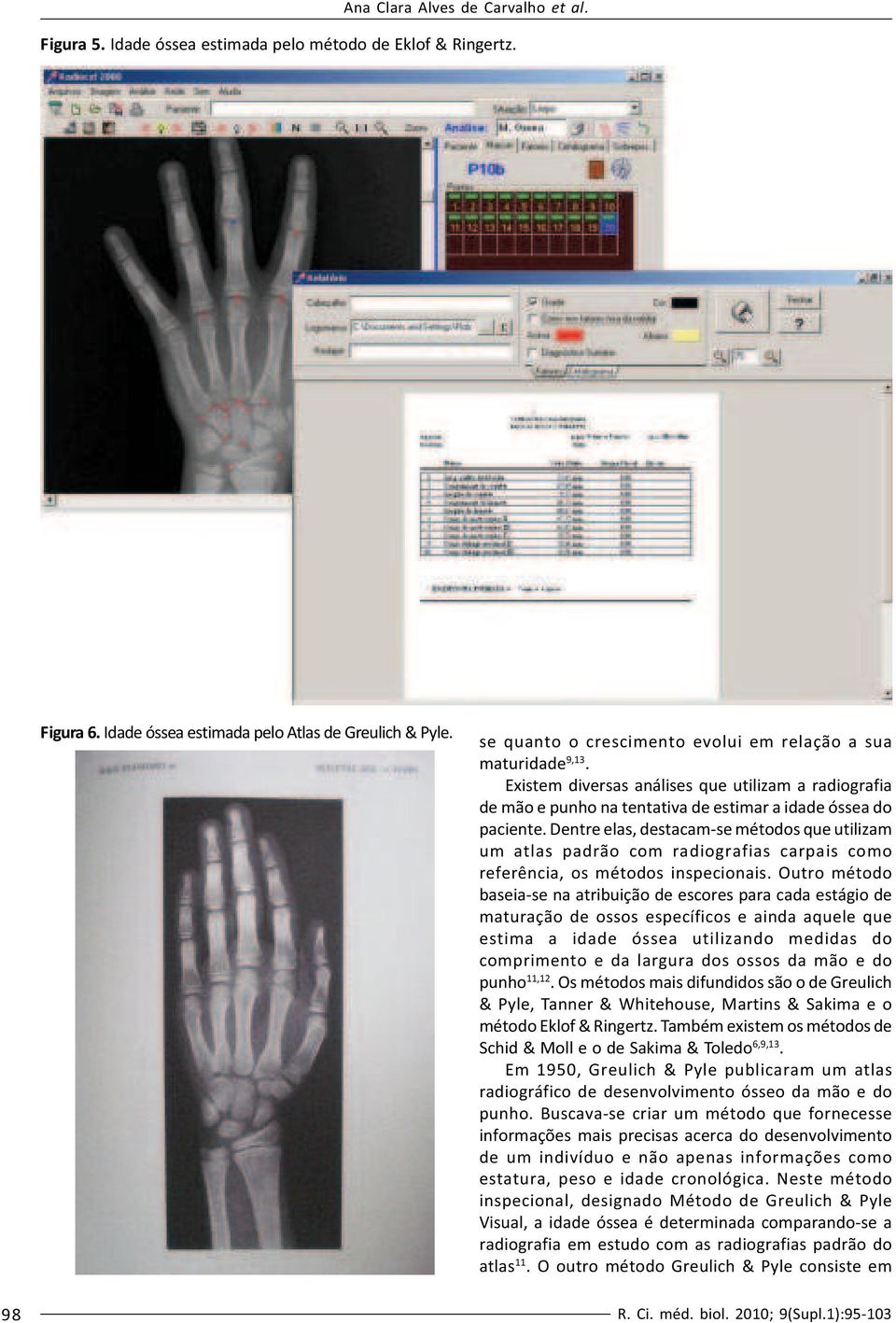 Dentre elas, destacam-se métodos que utilizam um atlas padrão com radiografias carpais como referência, os métodos inspecionais.