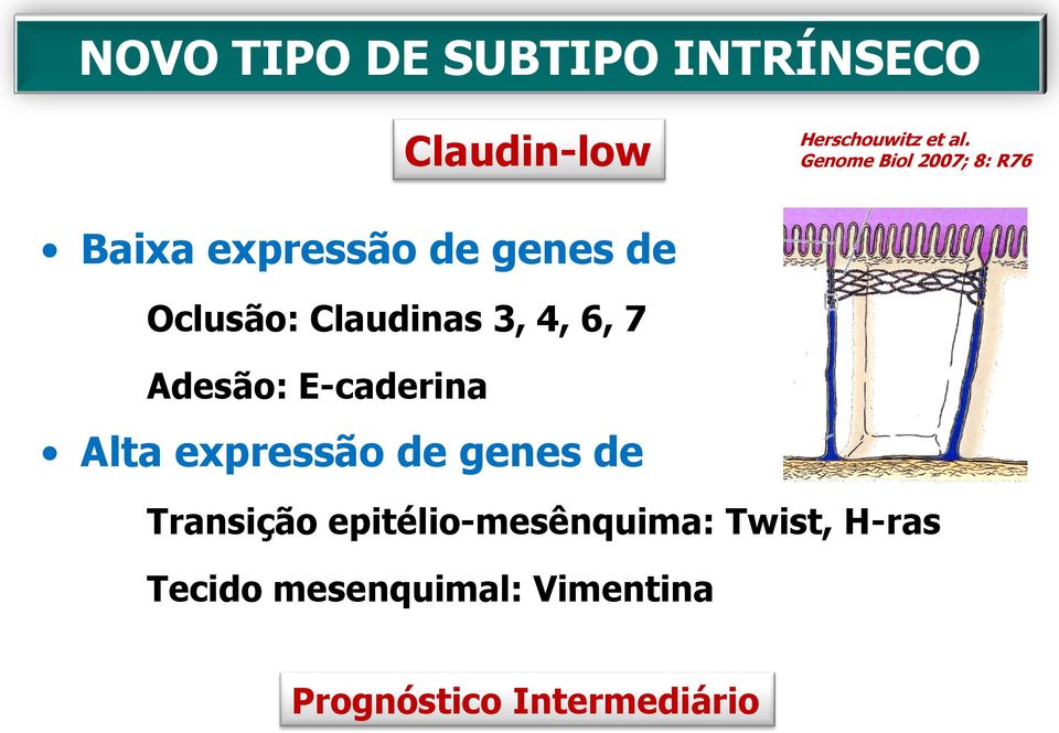 3, 4, 6, 7 Adesão: E-caderina Alta expressão de genes de Transição