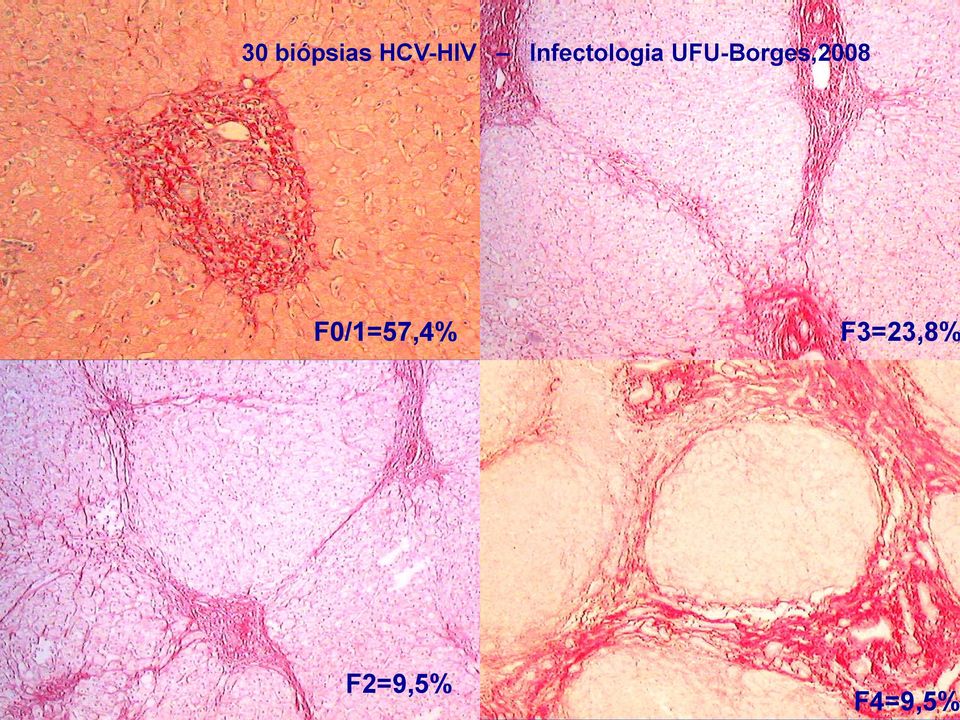 UFU-Borges,2008