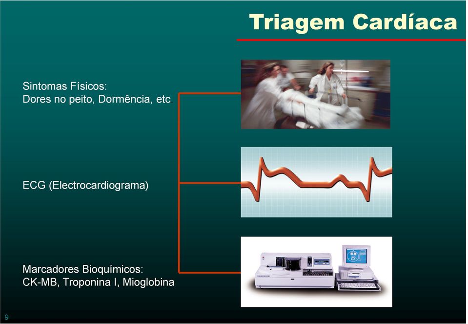 ECG (Electrocardiograma) Marcadores