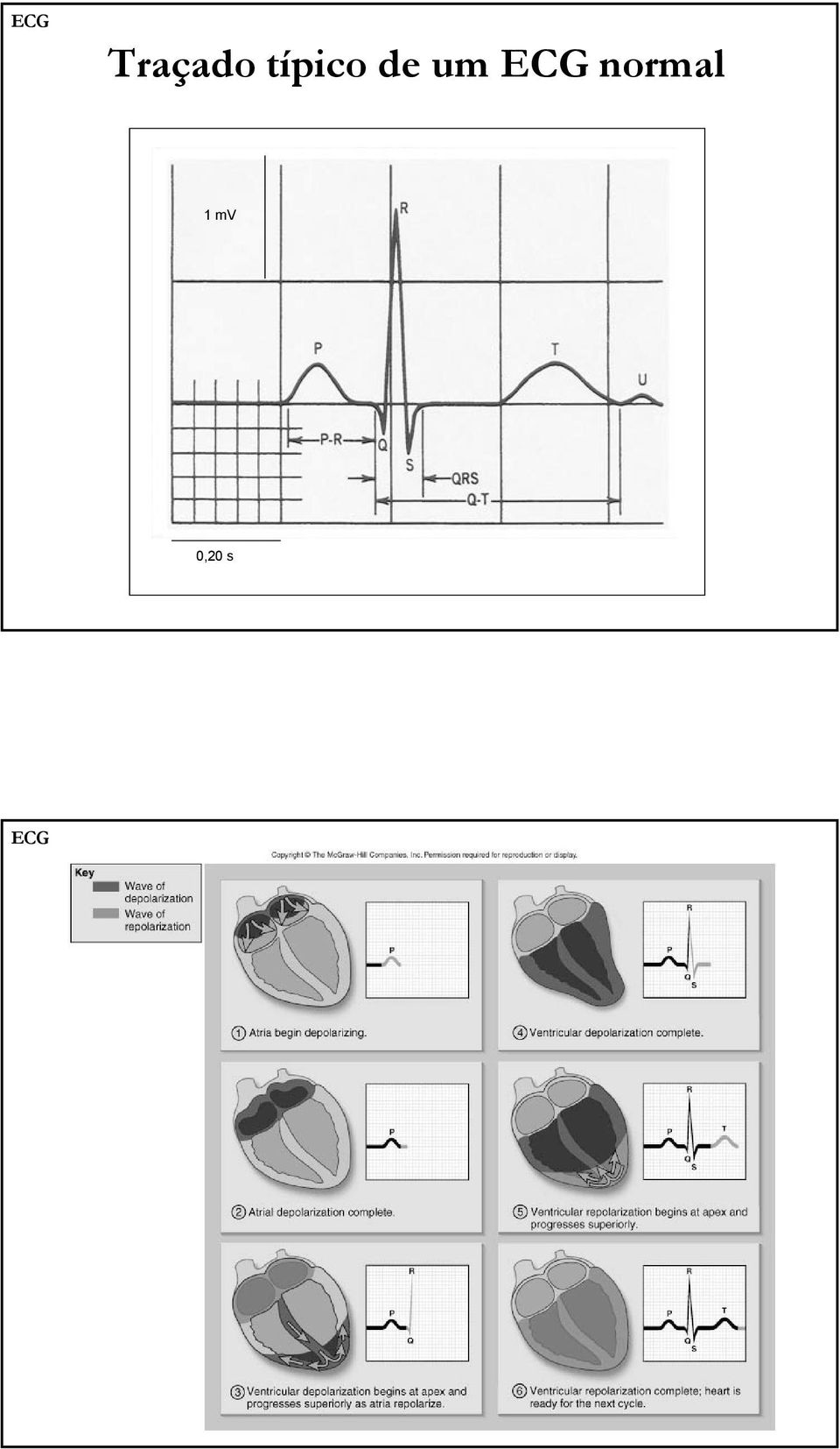 ECG normal 1