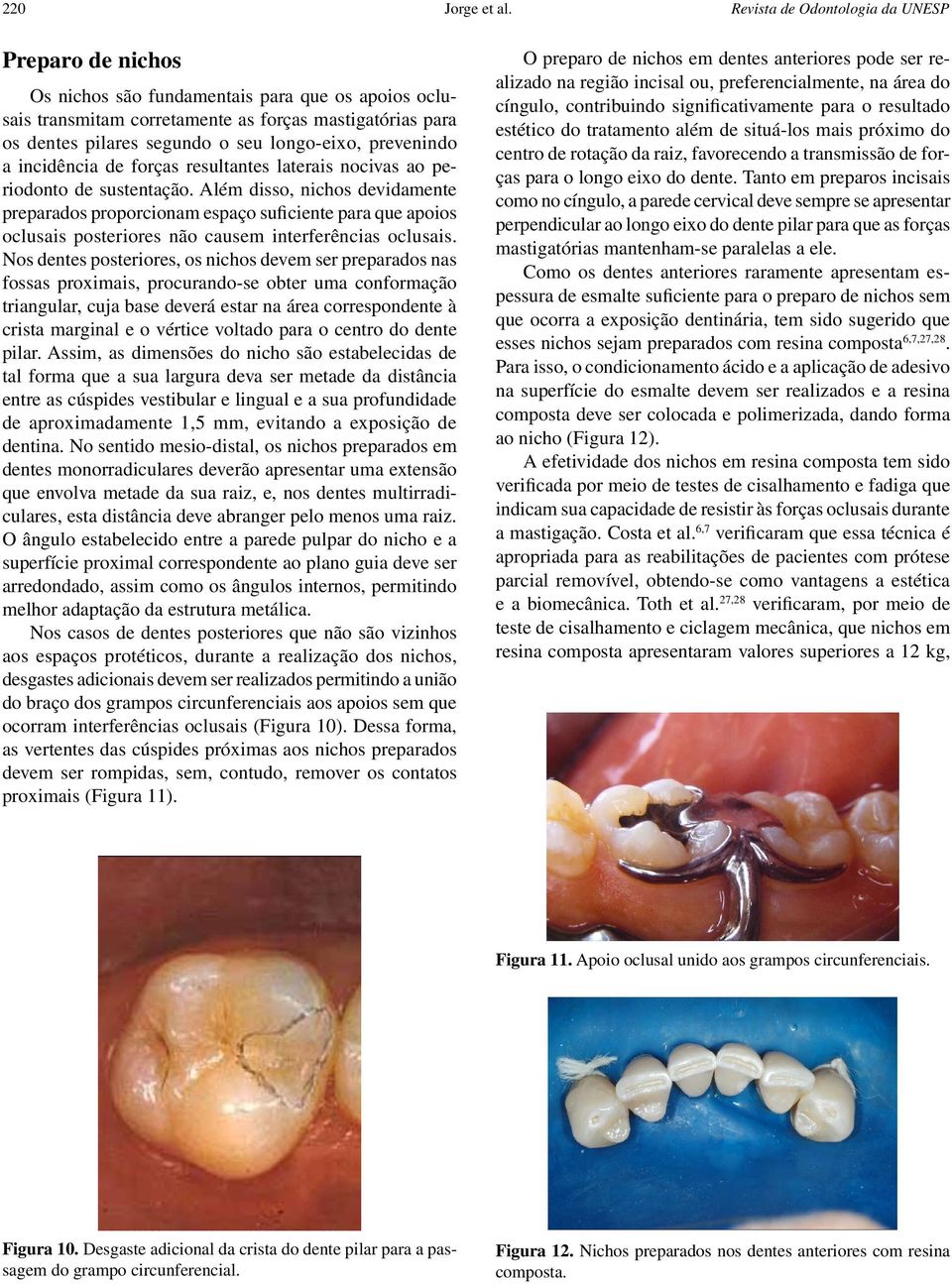 longo-eixo, prevenindo a incidência de forças resultantes laterais nocivas ao periodonto de sustentação.