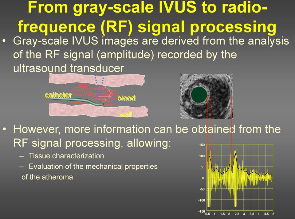 However, more information can be obtained from the RF signal processing, allowing: 150 Tissue