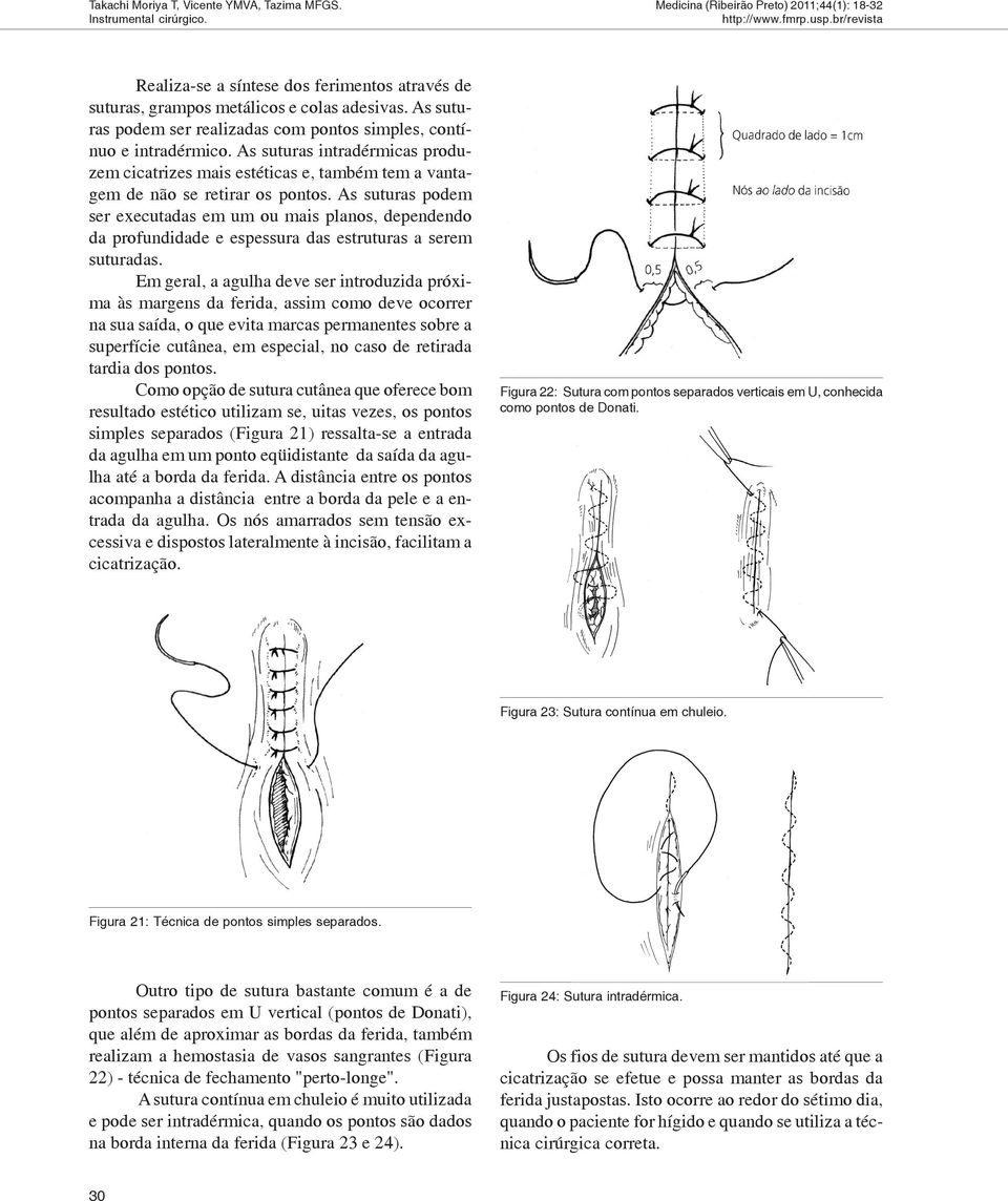 As suturas podem ser executadas em um ou mais planos, dependendo da profundidade e espessura das estruturas a serem suturadas.