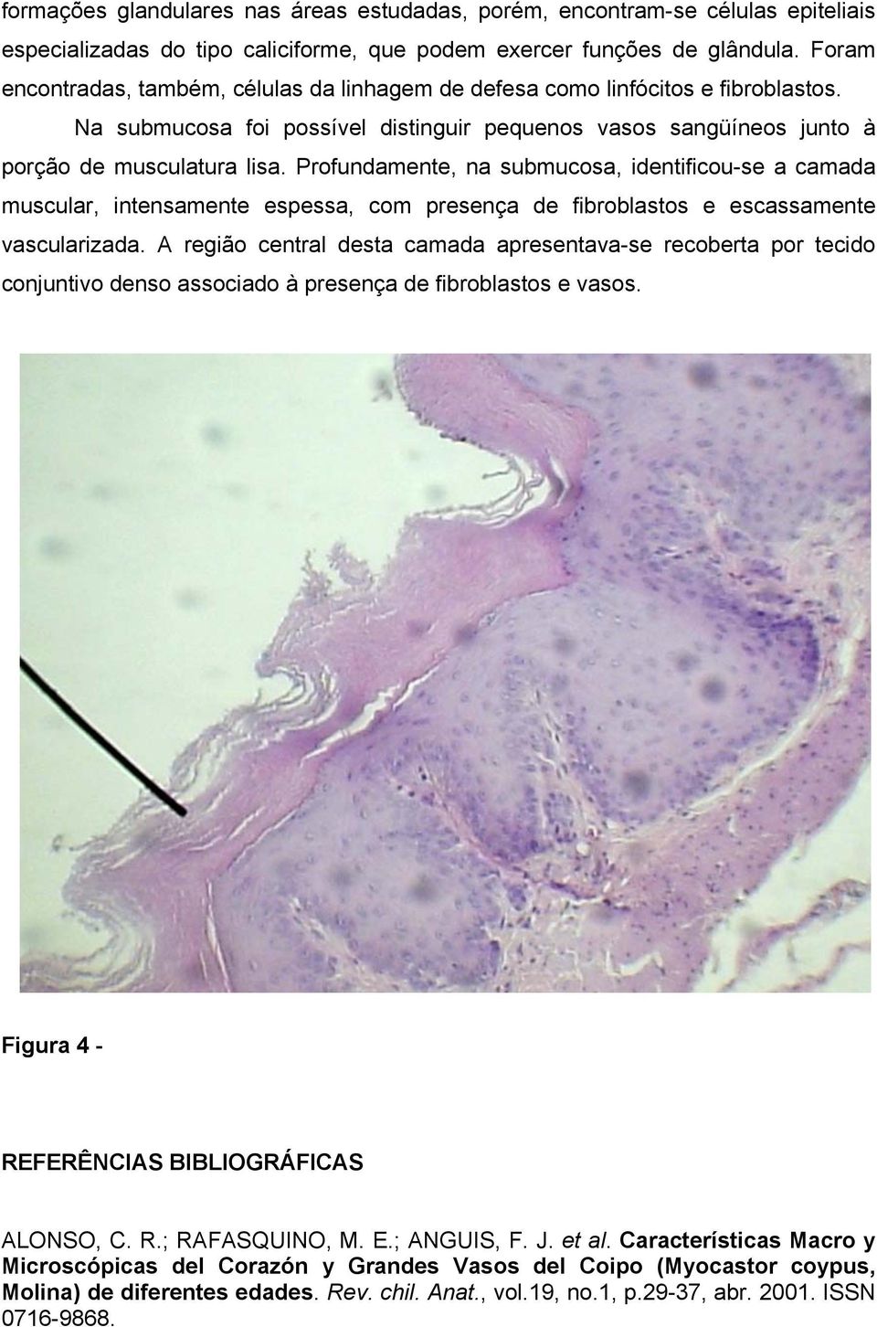 Profundamente, na submucosa, identificou-se a camada muscular, intensamente espessa, com presença de fibroblastos e escassamente vascularizada.