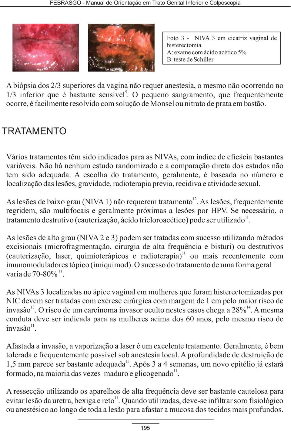 TRATAMENTO Vários tratamentos têm sido indicados para as NIVAs, com índice de eficácia bastantes variáveis. Não há nenhum estudo randomizado e a comparação direta dos estudos não tem sido adequada.