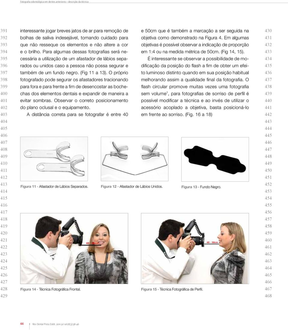 Para algumas dessas fotografias será necessária a utilização de um afastador de lábios separados ou unidos caso a pessoa não possa segurar e também de um fundo negro. (Fig 11 a 13).