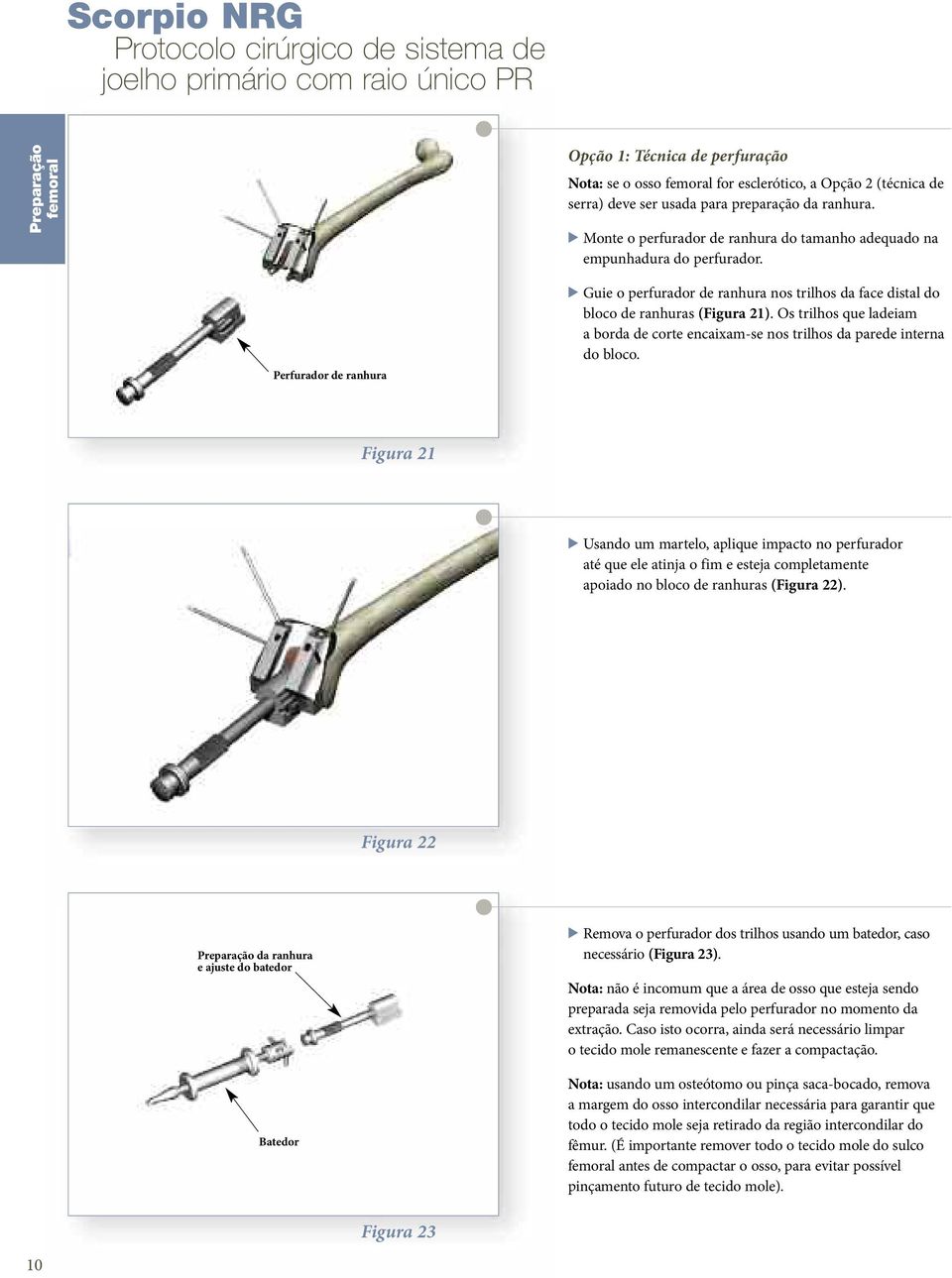 Perfurador de ranhura > Guie o perfurador de ranhura nos trilhos da face distal do bloco de ranhuras (Figura 21).