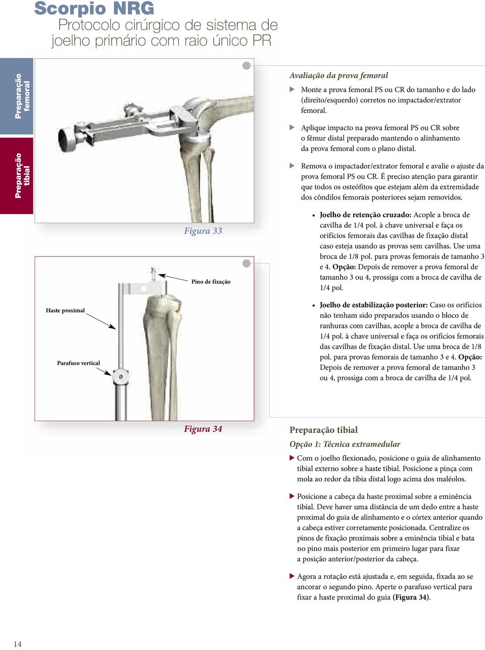 > Remova o impactador/extrator femoral e avalie o ajuste da prova femoral PS ou CR.